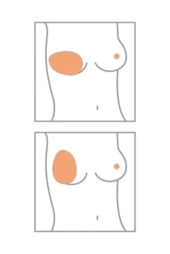 Amoena Teilprothese Balance Essential Thin Oval 5 Amoena Teilprothese Balance Essential Thin Oval -Femina Verkauf Amoena Brustprothesen Form Oval min 1280x1280 1