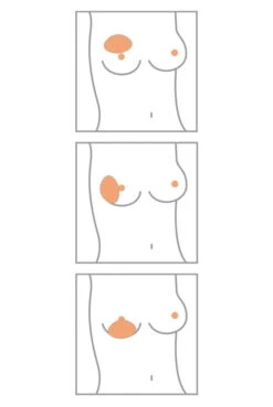 Amoena Teilprothese Balance Contact Spezial Varia 5 Amoena Teilprothese Balance Contact Spezial Varia -Femina Verkauf Amoena Brustprothesen Form Varia min 1280x1280 1